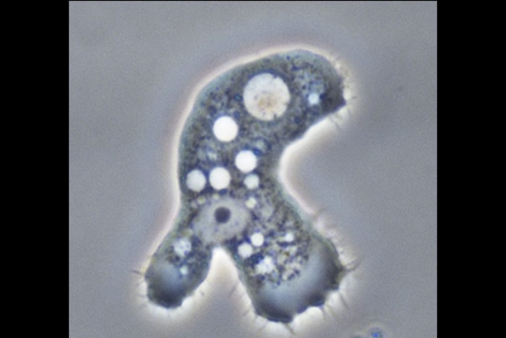 acanthamoeba